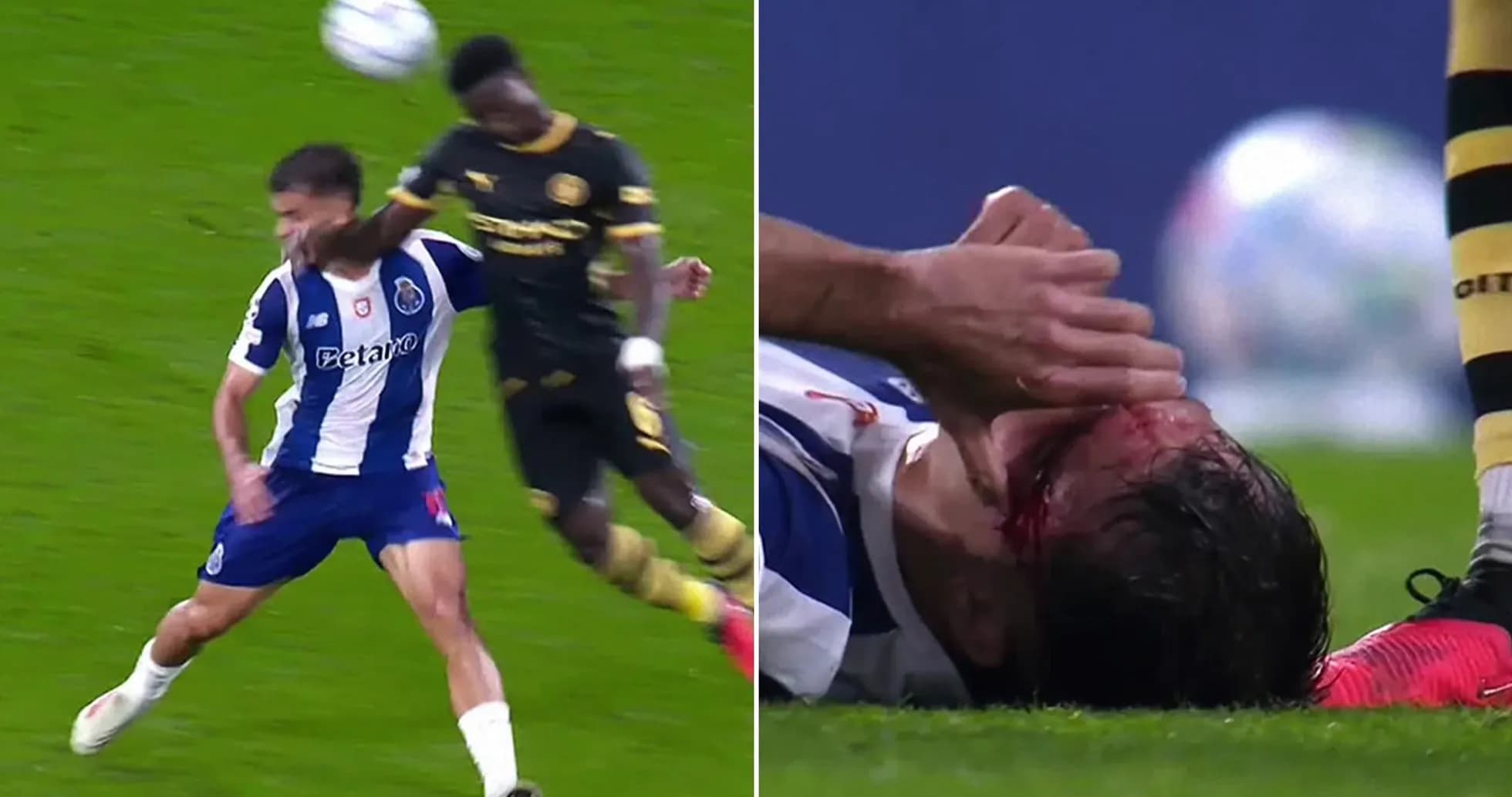 Player injured on the ground after collision during match