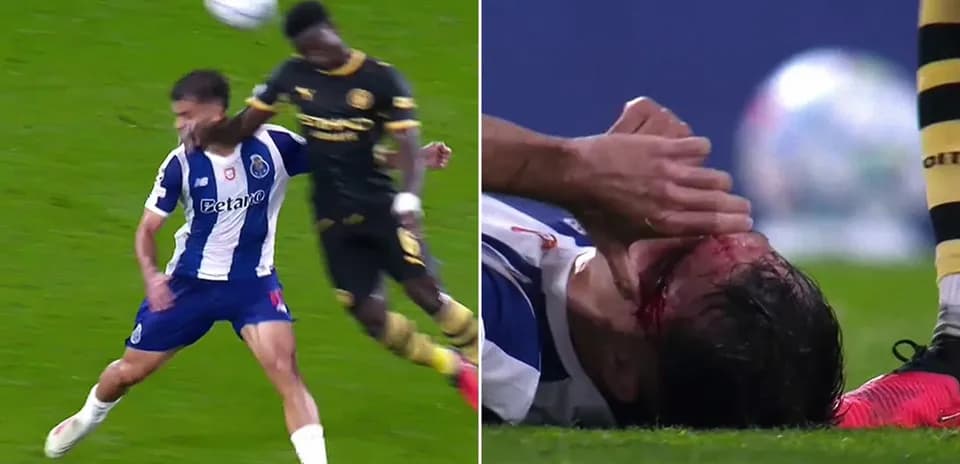 Player injured on the ground after collision during match